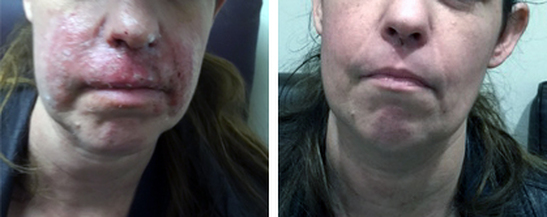 Car Accident — Before